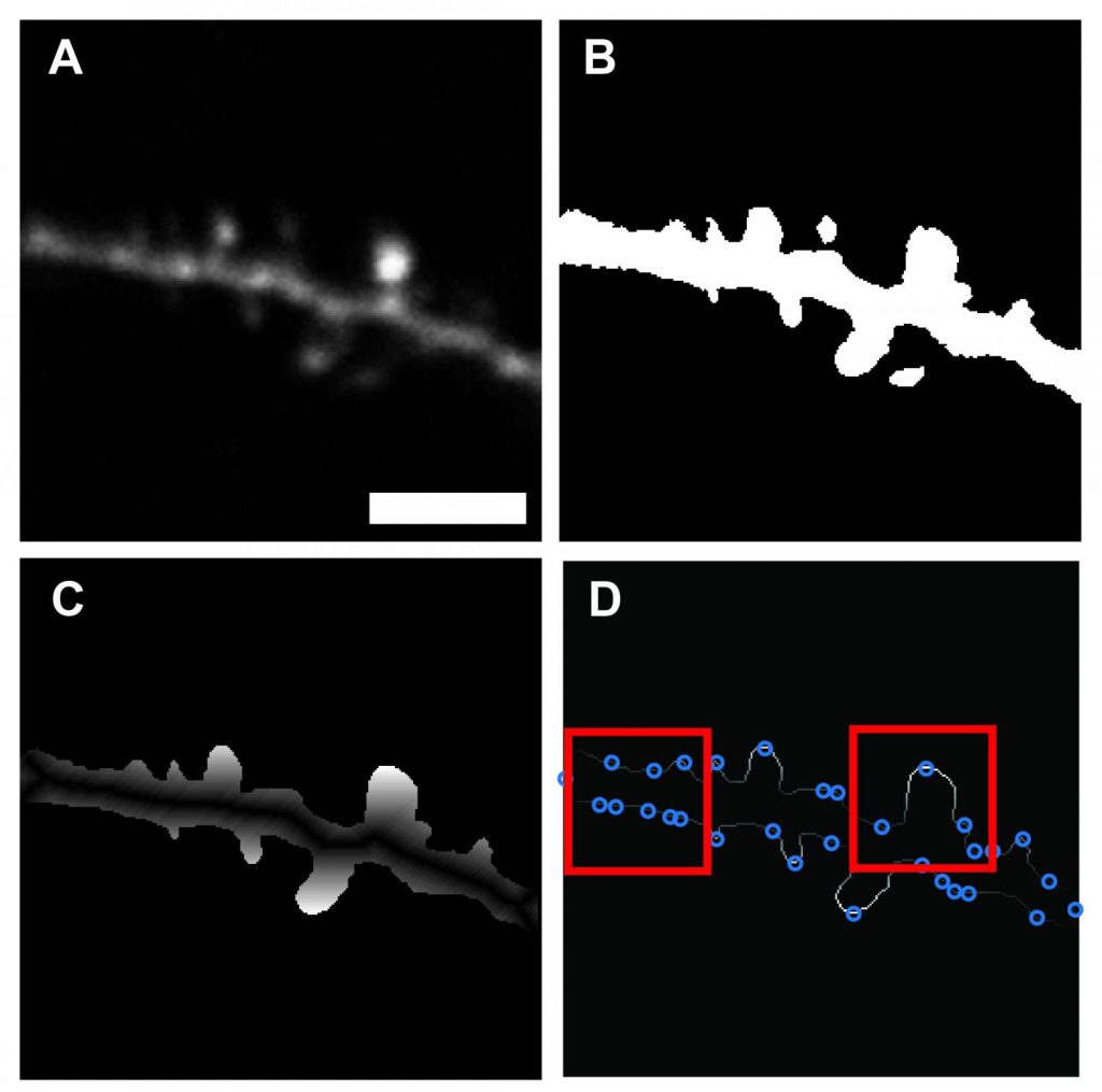 New software designed for rapid automated identification of dendritic spines